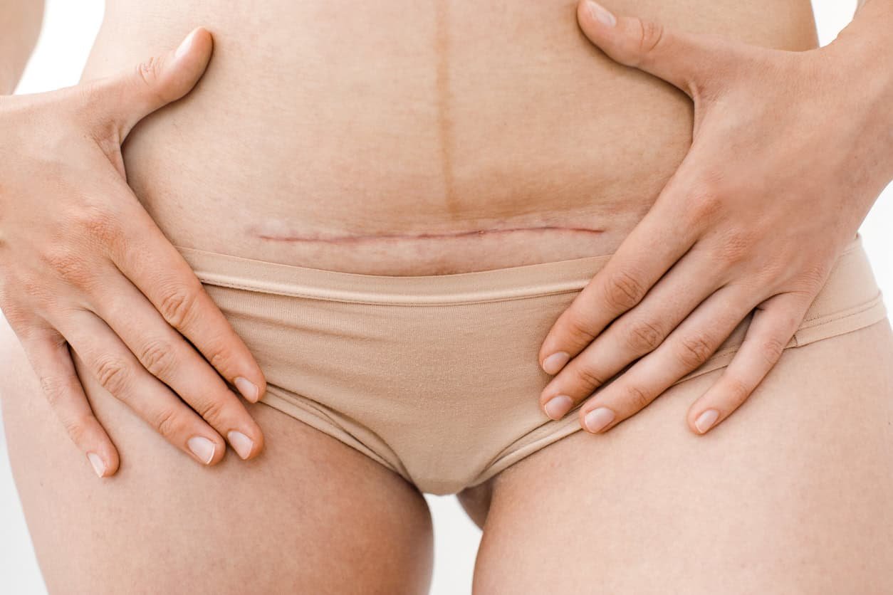 What to Expect During a C-Section: Part 2 – Podcast Ep 176