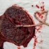 human placenta in the hospital